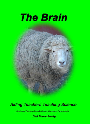 The Brain